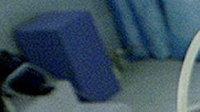 Liposuccion en China