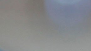 Asli Ilhan, de 42 años de edad, sintió que su rostro se quemaba.