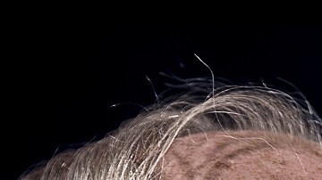 10 síntomas tempranos de Alzheimer que no debes ignorar