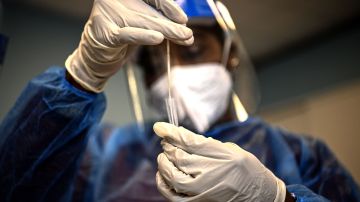 La FDA está estudiando el desempeño de las pruebas caseras, también conocidas como de "antígeno".