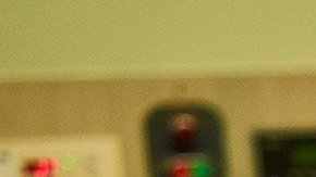 cirujia-equivocada-amputacion