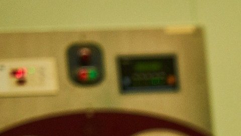 cirujia-equivocada-amputacion