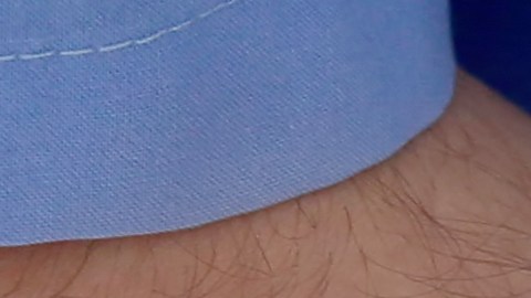 Demanda cirujano plástico