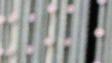Egan Bernal superó dos nuevas cirugías
