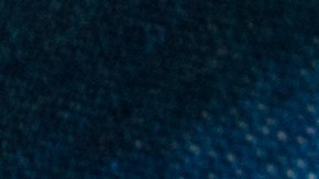 Enfermedad del beso esclerosis múltiple