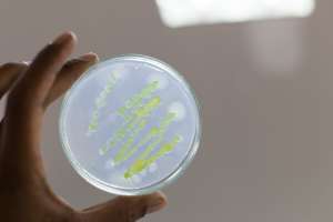 Las infecciones por bacterias resistentes a antibióticos matan más personas que la malaria y el sida