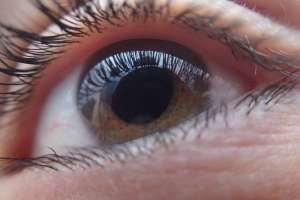 Síndrome de Marfan: La rara enfermedad detrás de los problemas de la vista y el dolor de espalda