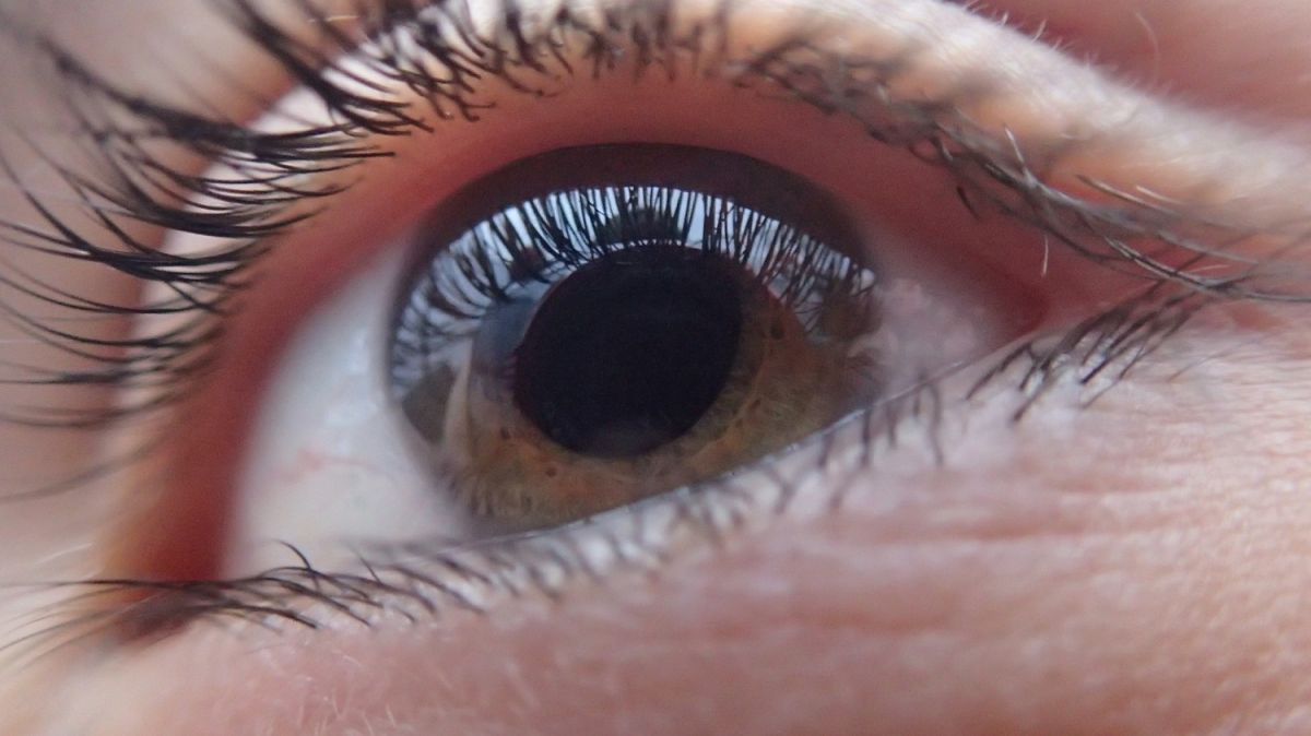 El síndrome de Marfan se detecta por problemas oculares y cardiacos.
