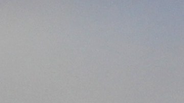 Cirugías Barbie humana