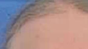 Gregory y Brandon Case