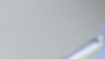 Sin tratamiento, las infecciones con la variante VB probablemente progresarían a SIDA.