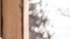 El ataque de los perros provocó que la mujer perdiera ambos brazos.