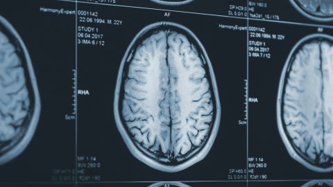 Covid Cerebro