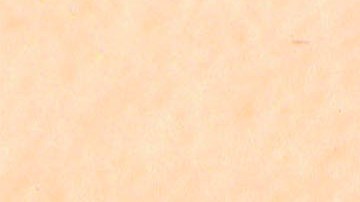 Se esperan aumentos de enfermedades transmitidas por garrapatas.