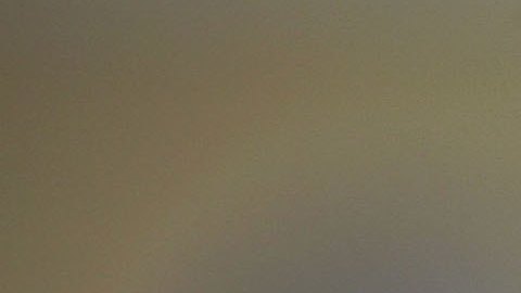 Cirugía de su hija, Tatiana Murillo