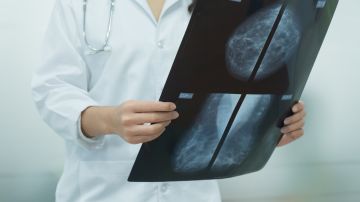 Foto de una doctora revisando una radiografía
