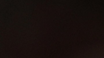 Ben Simmons será operado por lesión en la espalda