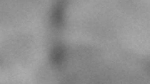 Científicos apuntan a que la viruela del mono evolucionó mientras infectaba a los humanos.