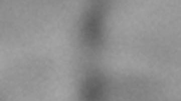 Al menos 20 casos de viruela del mono en Londres.