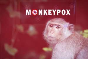 10 razones para ser optimistas y no preocuparse por la Viruela del mono