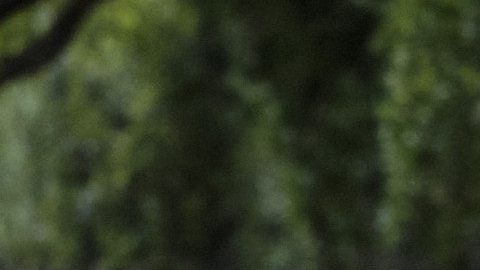 Justin Bieber también fue diagnóstico de síndrome de Ramsay Hunt.