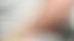 Manny Machado justo en el momento en el que se dobla su tobillo izquierdo al pisar mal la almohadilla de primera base.