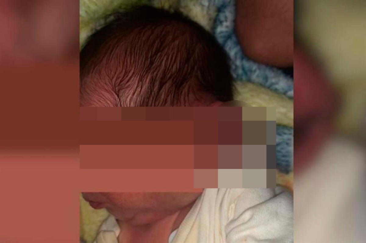 Médicos cortan oreja izquierda a bebé durante cesárea alumbrada con celulares.