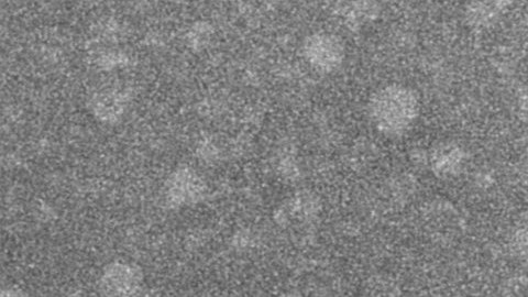 Partículas virales del virus del mono observadas con microscopio electrónico.