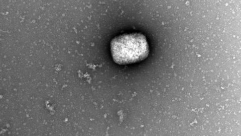 Partículas virales del virus del mono observadas con microscopio electrónico.