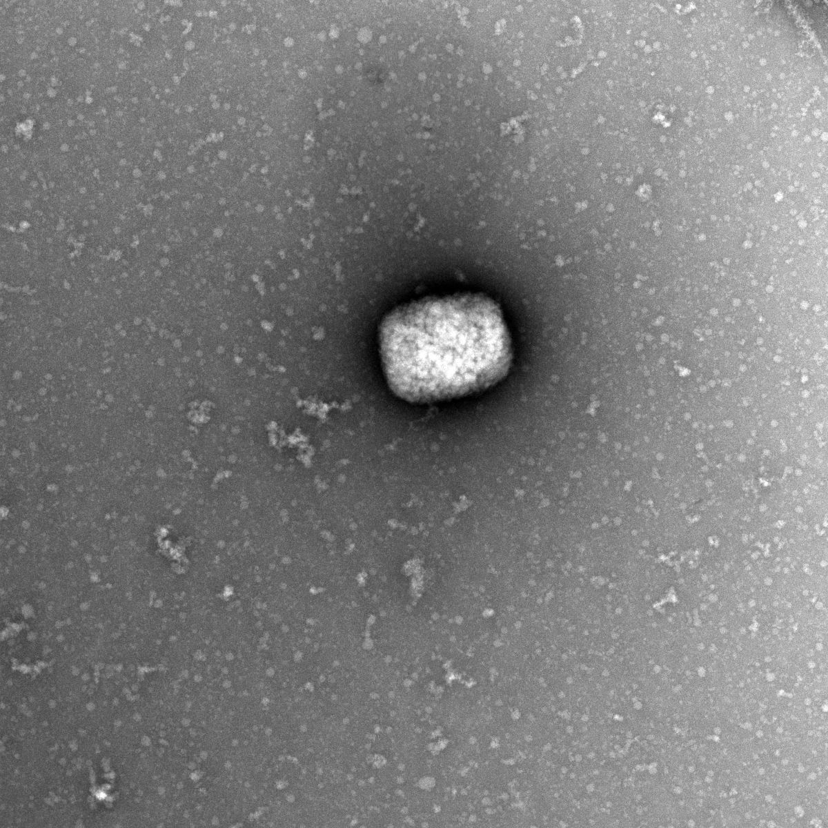 Partículas virales del virus del mono observadas con microscopio electrónico.