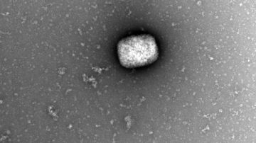 Partículas virales del virus del mono observadas con microscopio electrónico.
