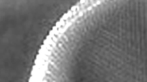 Los implantes 'Rosgrud' fueron creados por el famoso cirujano plástico Dobreikin Evgeny Alekseevich.
