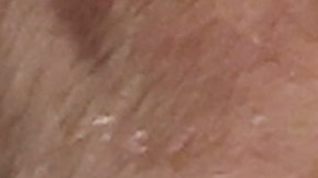 A Pete Alonso aún le cuesta superar el trauma del accidente de tránsito que casi acaba con su vida el pasado mes de marzo.