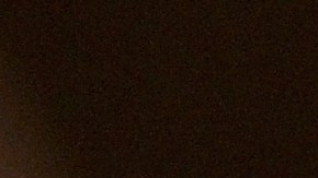 La cantante Thalía revela a través de TikTok lo que padece día a día con la enfermedad que le diagnosticaron.