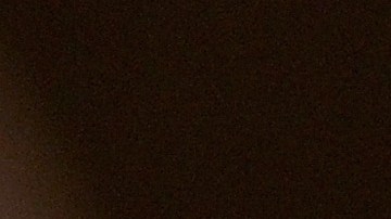 La cantante Thalía revela a través de TikTok lo que padece día a día con la enfermedad que le diagnosticaron.