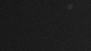 La niña de 11 años tuvo que ser intervenida en el hospital.