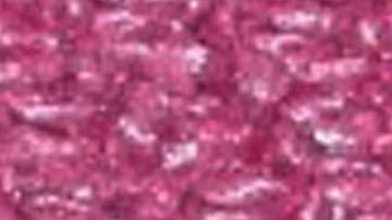 Monkey Pox Lesions