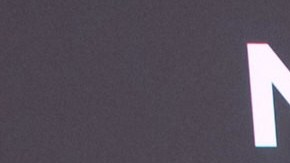 La modelo Jessica Cediel habló de su experiencia con los biopolímeros.