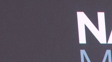 La modelo Jessica Cediel habló de su experiencia con los biopolímeros.