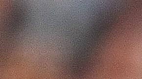 Senzatela estará alejado entre seis y ocho meses de los diamantes de juego.