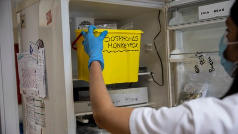 California Illinois viruela del mono