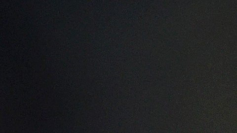 Severino integra la lista de lesionados de 60 días.