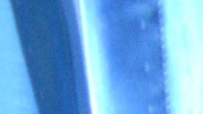 Varios hombres están documentando sus vasectomías en TikTok.