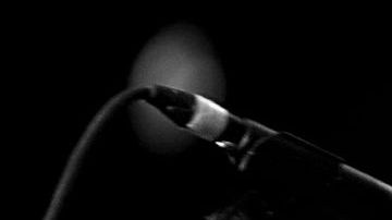 'Marciano' Cantero, de los Enanitos Verdes, fue internado en terapia intensiva.