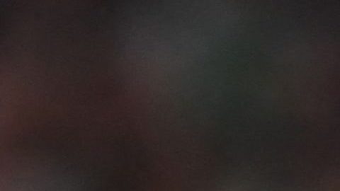 Karim Benzema sufre una lesión doble en el muslo derecho.