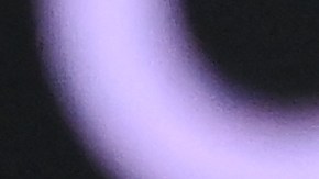 El defensor francés sufrió una lesión en el partido ante Austria.