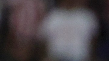 Paul Pogba decidió este lunes terminar con la terapia conservadora que seguía para recuperarse de su lesión en el menisco de su rodilla derecha.