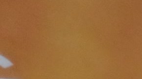 Las autoridades ponen el acento en campañas de vacunación para toda la familia.