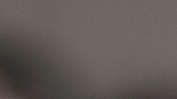 Katy Perry perdió el control de su párpado derecho y aunque sólo fueron unos instantes las imágenes han dado la vuelta al mundo.