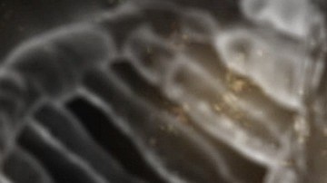 La mutación nunca antes vista hizo que las células sanguíneas de la mujer se volvieran aneuploides.